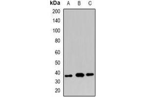 Western blot analysis of XRCC3 expression in HeLa (A), mouse kidney (B), rat kidney (C) whole cell lysates.