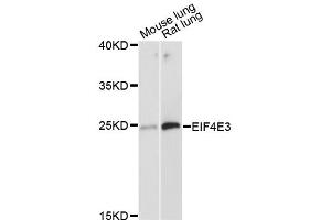Western blot analysis of extracts of various cell lines, using EIF4E3 antibody (ABIN6292064) at 1:3000 dilution. (EIF4E3 抗体)