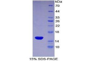 SDS-PAGE (SDS) image for Complement Decay-Accelerating Factor (CD55) (AA 254-372) protein (His tag) (ABIN2120948) (CD55 Protein (AA 254-372) (His tag))
