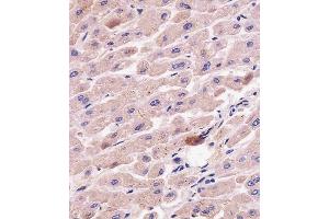 C staining G7L in human liver tissue sections by Immunohistochemistry (IHC-P - paraformaldehyde-fixed, paraffin-embedded sections). (ATG7 抗体  (AA 494-523))
