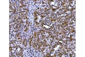 anti-MutL Homolog 1 (MLH1) (AA 108-756) antibody