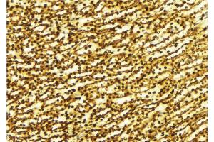 Immunohistochemistry (IHC) image for anti-Sirtuin 1 (SIRT1) (N-Term) antibody (ABIN6265090)