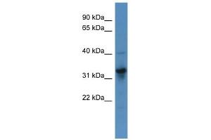 WB Suggested Anti-T Antibody Titration:  0. (T Brachyury Protein (N-Term) 抗体)