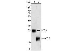 Western Blot showing MYL3 (1) and MYL2 (2) antibody used against rat fetal heart tissues lysate. (MYL3/CMLC1 抗体)