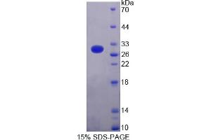 Image no. 1 for Cardiac Troponin I (TNNI3) (AA 2-211) protein (His tag) (ABIN4988436) (TNNI3 Protein (AA 2-211) (His tag))