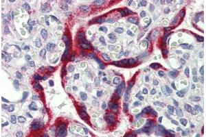 Placenta, Human: Formalin-Fixed, Paraffin-Embedded (FFPE) (MKNK2 抗体  (AA 36-85))