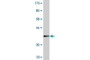 Western Blot detection against Immunogen (36. (TNNI2 抗体  (AA 2-100))