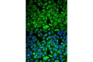 Immunofluorescence analysis of HeLa cell using PEBP1 antibody. (PEBP1 抗体)