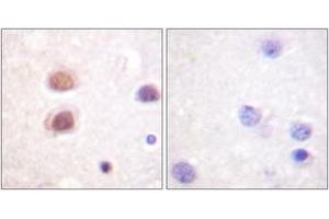 Immunohistochemistry analysis of paraffin-embedded human brain, using p38 MAPK (Phospho-Tyr322) Antibody. (MAPK14 抗体  (pTyr322))