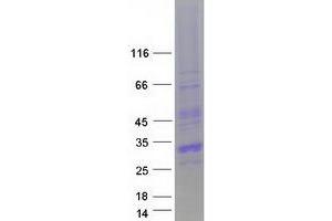 Western Blotting (WB) image for Cbp/p300-Interacting Transactivator, with Glu/Asp-Rich Carboxy-terminal Domain, 1 (CITED1) (Transcript Variant 1) protein (Myc-DYKDDDDK Tag) (ABIN2714198)