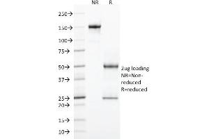 SDS-PAGE Analysis Purified CD103 Mouse Monoclonal Antibody (ITGAE/2474). (CD103 抗体)