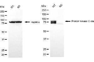 Western blotting analysis using protein kinase C eta antibody (ABIN7799997). (Recombinant PKC eta 抗体)