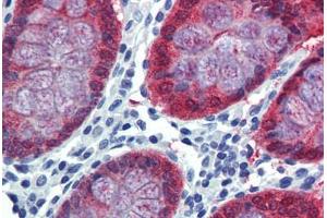 Colon, Human: Formalin-Fixed, Paraffin-Embedded (FFPE) (HOXC8 抗体  (AA 35-84))
