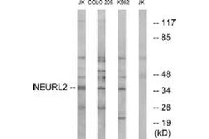Western blot analysis of extracts from Jurkat/COLO/K562 cells, using NEURL2 Antibody. (NEURL2 抗体  (AA 99-148))