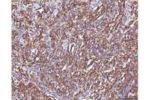 IHC analysis of ENO1 using anti-ENO1 antibody (ABIN7601902).