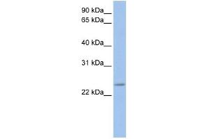 WB Suggested Anti-FKBP3 Antibody Titration: 0. (FKBP3 抗体  (C-Term))