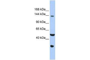 WB Suggested Anti-WDHD1 Antibody Titration: 0. (WDHD1 抗体  (C-Term))