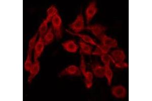 ABIN6269030 staining HeLa by IF/ICC. (p63 抗体)
