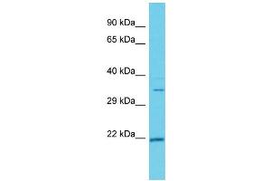 Host: Rabbit  Target Name: Hmgcl  Sample Tissue: Rat Thymus lysates  Antibody Dilution: 1. (HMGCL 抗体  (C-Term))