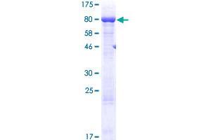 AARSD1 Protein (AA 1-525) (GST tag)