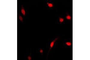 Immunofluorescent analysis of NF-kappaB p65 staining in MCF7 cells. (NF-kB p65 抗体  (Center))