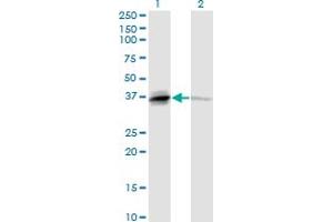 Western Blot analysis of TNFSF13B expression in transfected 293T cell line by TNFSF13B monoclonal antibody (M04), clone 2C11. (BAFF 抗体  (AA 1-285))