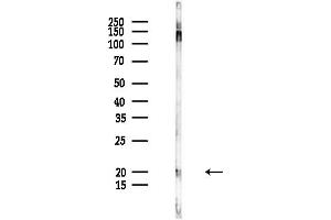 anti-Complexin 2 (CPLX2) (Internal Region) antibody