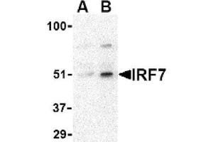 Image no. 1 for anti-Interferon Regulatory Factor 7 (IRF7) (Middle Region) antibody (ABIN265130) (IRF7 抗体  (Middle Region))
