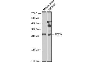 Western blot analysis of extracts of various cell lines, using SOX14 antibody (ABIN6130912, ABIN6148291, ABIN6148293 and ABIN6223049) at 1:1000 dilution. (SOX14 抗体  (AA 91-240))