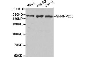 Western Blotting (WB) image for anti-Small Nuclear Ribonucleoprotein 200kDa (U5) (SNRNP200) antibody (ABIN1877090) (SNRNP200 抗体)