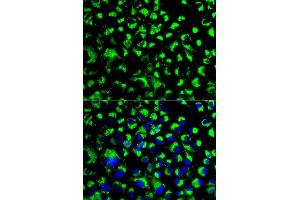 Immunofluorescence analysis of U2OS cells using HSPA9 antibody. (HSPA9 抗体  (AA 380-679))