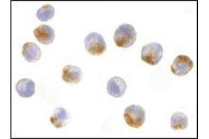 Immunocytochemistry of NAIP in A549 cells with NAIP antibody at 10 μg/ml. (NAIP 抗体  (C-Term))