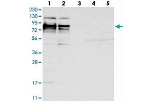 Western blot analysis of Lane 1: RT-4, Lane 2: U-251 MG, Lane 3: Human Plasma, Lane 4: Liver, Lane 5: Tonsil with HS6ST2 polyclonal antibody  at 1:250-1:500 dilution. (HS6ST2 抗体)
