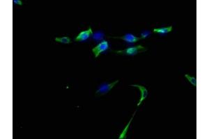 Immunofluorescence staining of U87 cells with ABIN7139803 at 1:50, counter-stained with DAPI. (DNER 抗体  (AA 150-168))