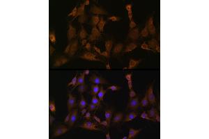 Immunofluorescence (IF) image for anti-Staphylococcal Nuclease Domain Containing Protein 1 (SND1) (AA 26-285) antibody (ABIN6148197)