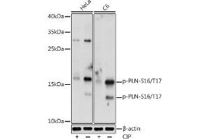 Western blot analysis of extracts of various cell lines, using Phospho-PLN-S16/T17 antibody (ABIN7269330) at 1:1000 dilution. (Phospholamban 抗体  (pSer16, pThr17))