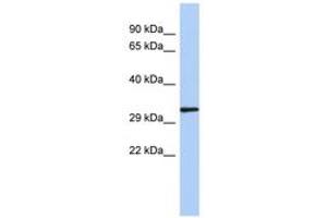 Image no. 1 for anti-NK2 Homeobox 2 (Nkx2-2) (N-Term) antibody (ABIN6742264) (Nkx2-2 抗体  (N-Term))