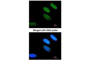 ICC/IF Image Immunofluorescence analysis of paraformaldehyde-fixed HeLa, using TAFII68 , antibody at 1:200 dilution.