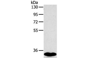 Western Blot analysis of Human fetal intestines tissue using SULT1B1 Polyclonal Antibody at dilution of 1:800 (SULT1B1 抗体)