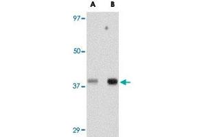 Western blot analysis of TREX1 in human spleen tissue lysate with TREX1 polyclonal antibody  at (A) 0. (TREX1 抗体  (Internal Region))