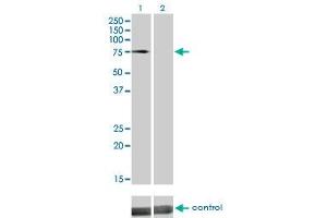 Western blot analysis of DMPK over-expressed 293 cell line, cotransfected with DMPK Validated Chimera RNAi (Lane 2) or non-transfected control (Lane 1).