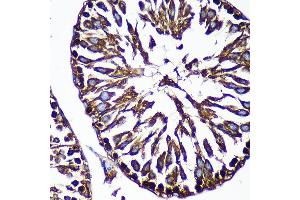 Immunohistochemistry (IHC) image for anti-Catenin (Cadherin-Associated Protein), alpha 3 (CTNNA3) (AA 1-240) antibody (ABIN7266136)