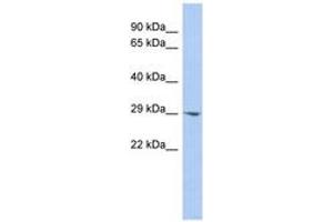 Image no. 1 for anti-Enoyl CoA Hydratase Domain Containing 2 (ECHDC2) (AA 143-192) antibody (ABIN6743494) (ECHDC2 抗体  (AA 143-192))