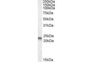 Image no. 2 for anti-Caveolin 3 (CAV3) (N-Term) antibody (ABIN375161) (Caveolin 3 抗体  (N-Term))