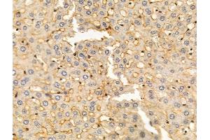 KIR2DL4 Antibody at 1/100 staining Rat liver tissue by IHC-P.