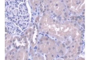 DAB staining on IHC-P; Samples: Human Kidney Tissue (Cathepsin H 抗体  (AA 23-335))