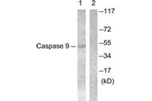 Western blot analysis of extracts from 293 cells, treated with Calyculin 50nM 30', using Caspase 9 (Ab-196) Antibody. (Caspase 9 抗体  (AA 162-211))
