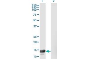 Western Blot analysis of MACF1 expression in transfected 293T cell line by MACF1 monoclonal antibody (M08), clone 1G9. (MACF1 抗体  (AA 1-95))