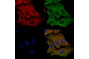ABIN6259546 and ABIN6276197 staining Hela cells by IF/ICC.