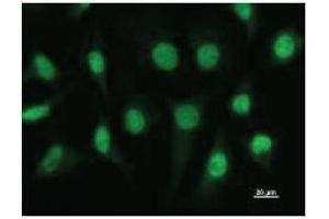 Immunostaining analysis in HeLa cells. (ETV3 抗体)